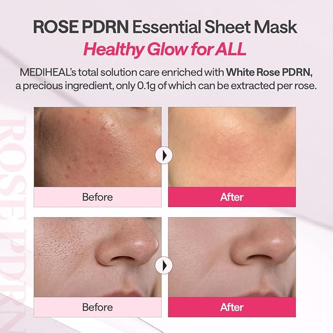 Mediheal Essential Face Mask [PDRN] Healthy Glow 10 pcs. with 99% Purity White Rose PDRN for Glass Skin, Pore Care, Skin Firming - Home Skin Care & Vegan Formula Korean Beauty Sheet Mask