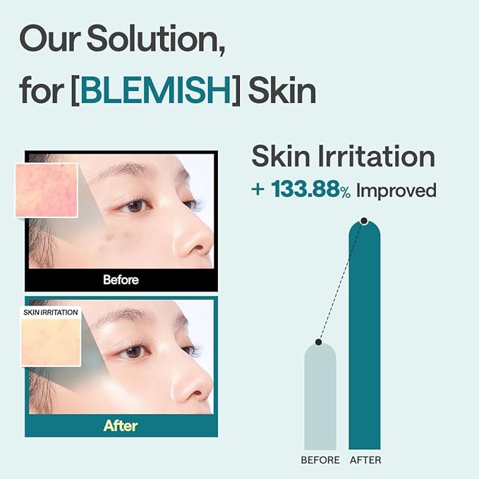 Mediheal Essential Face Mask [Madecassoside] Blemish Repair 4 pcs. with 98% Purity Madecassoside & Hyaluronic Acid - Soothing Care, Hydrating- Travel Essentials, Vegan Formula Korean Sheet Mask