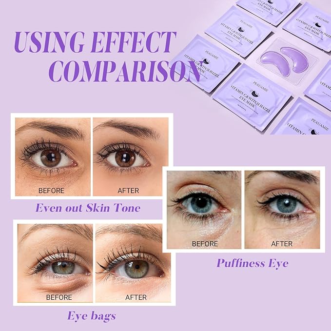 PEAUAMIE Under Eye Patches with Vitamin C and Witch Hazel Eye Mask for Dark Circles and Puffiness,Face Mask Skin Care Products 30 Pairs