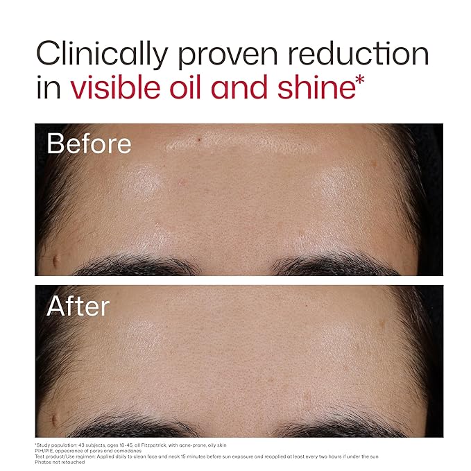 EltaMD UV Clear Blemish-Prone & Oil Balancing SPF 50, Non-Comedogenic Sunscreen with Zinc Oxide, Dermatologist Recommended