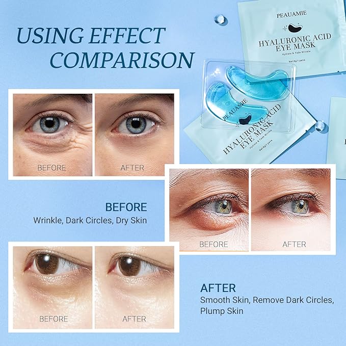 PEAUAMIE Under Eye Patchs Hyaluronic Acid Eye Mask for Dark Circles and Puffiness Wrinkle Eye Bags 30 Pairs